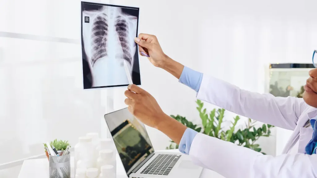 Pulmonologist examining a patient’s chest X-ray to review lung abnormalities