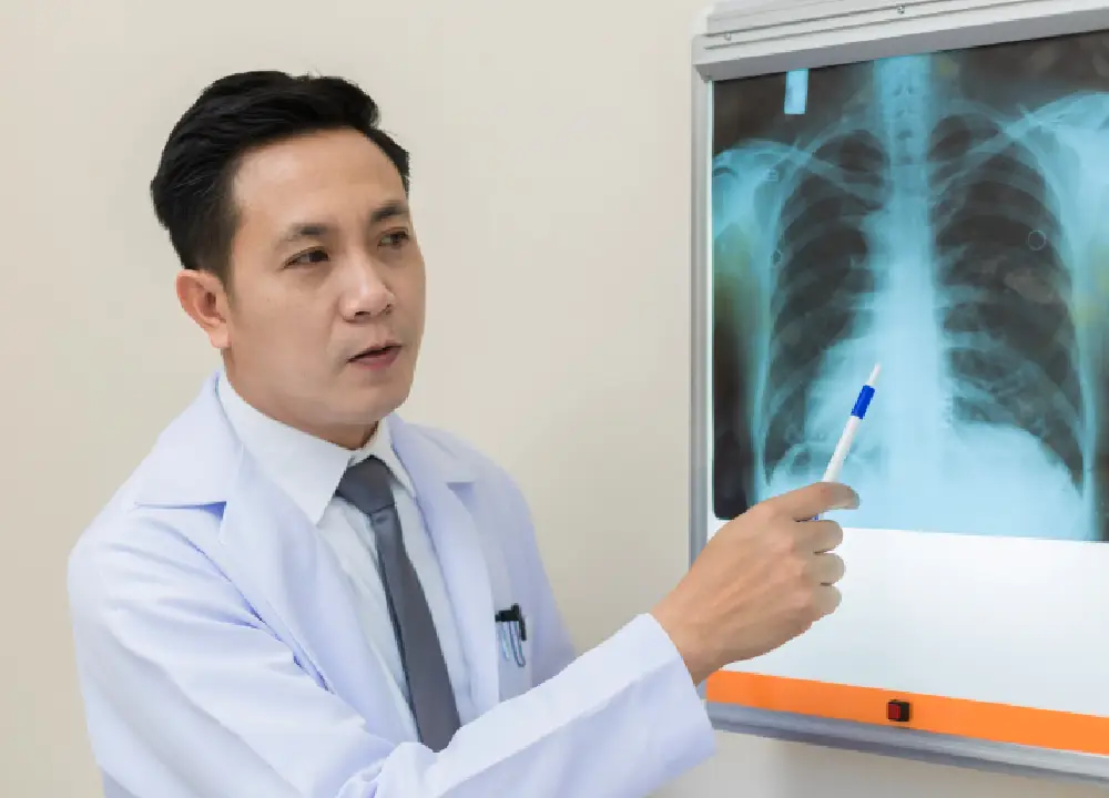 Essential Guide to Mesothelioma Compensation Options 2 Doctor examining a lung X-ray related to mesothelioma