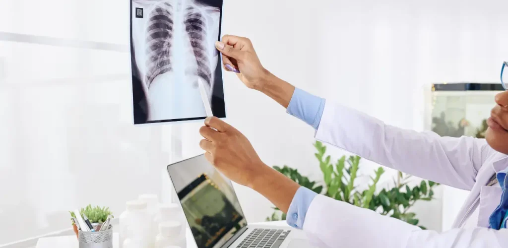 Pulmonologist examining a patient’s chest X-ray to review lung abnormalities